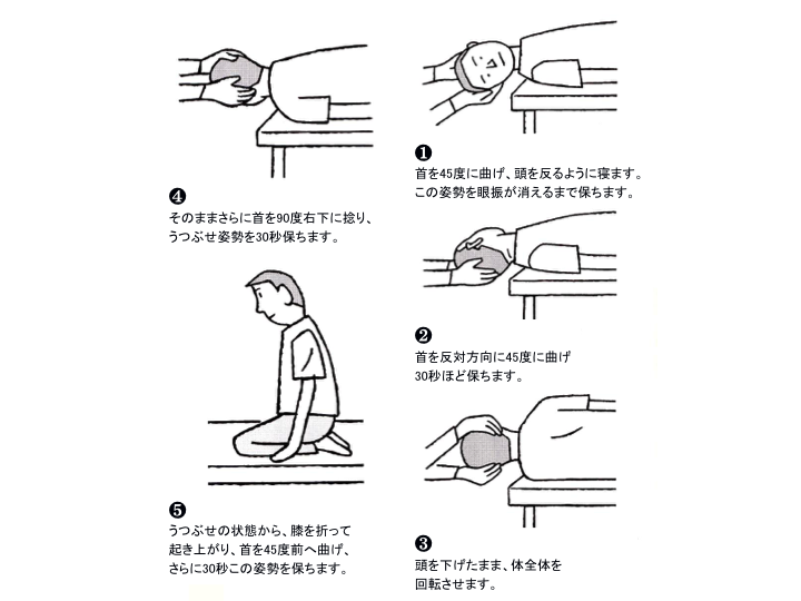 理学療法（エプリー法）の手順