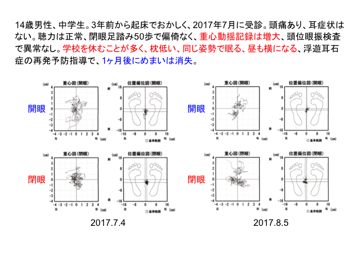 07 若い世代に多いめまい めまいの病気 めまいメニエール病センター 07 若い世代に多いめまい めまいの病気 めまいメニエール病センター