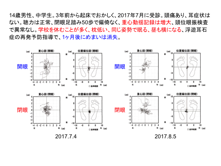 症例：14歳男性、中学生