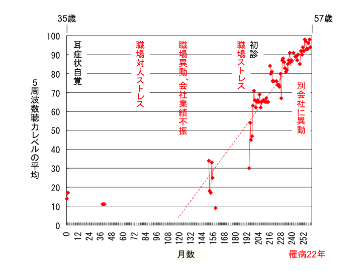 5周波数聴力レベルの平均