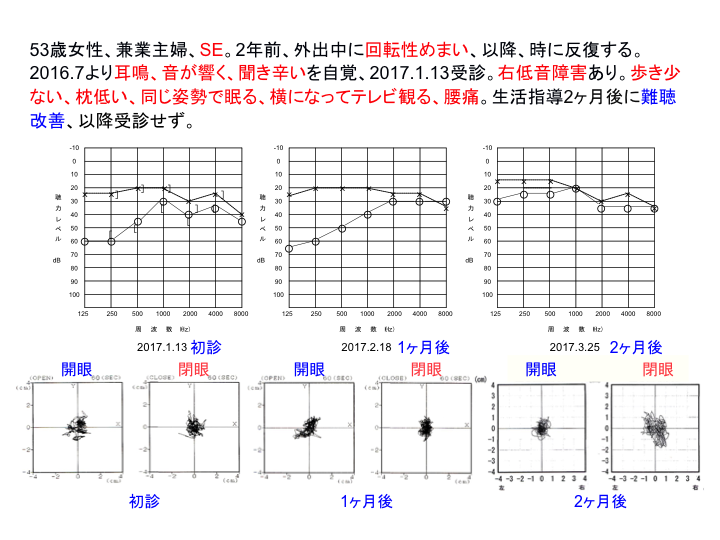 症例：53歳女性、専業主婦、SE