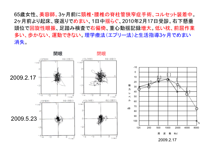 症例：65歳女性、美容師