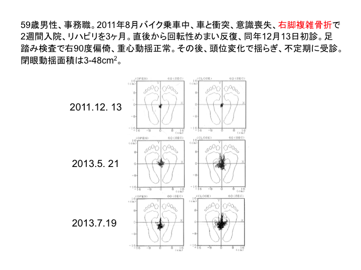 症例：59歳男性、事務職