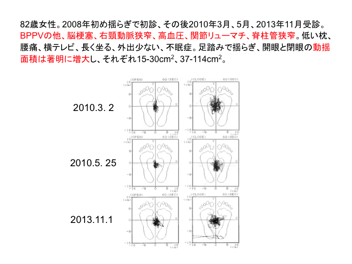 症例：82歳女性