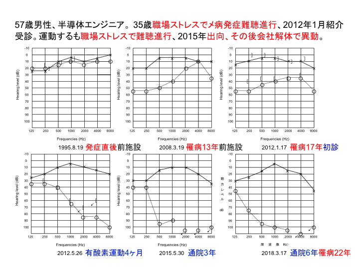 症例：57歳男性、半導体エンジニア