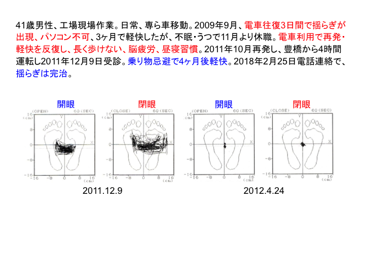 症例：41歳男性、工場現場作業