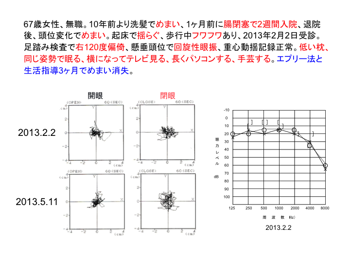 症例：67歳女性、無職